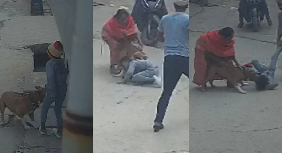 पिटबुल ने कान काटकर किया अलग, घर के बाहर खेल रहा था 6 साल का बच्चा; VIDEO वायरल