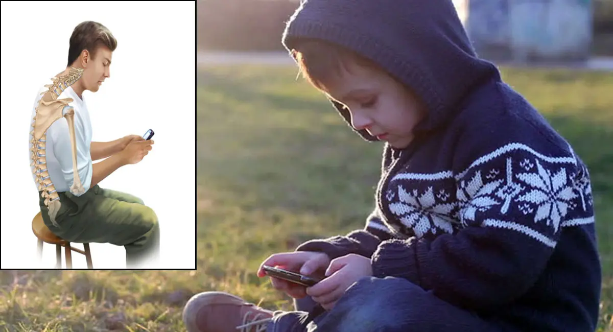 बच्चों का निकल रहा कूबड़, पांच साल में दोगुना बढ़ी परेशानी 