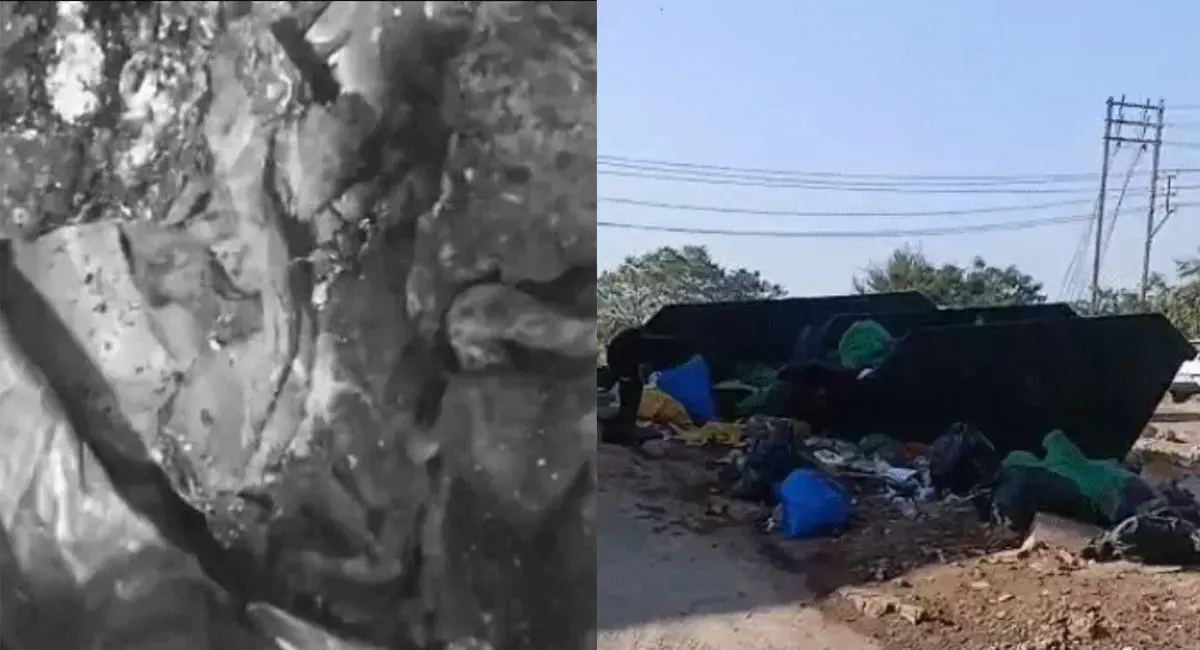 हमीदिया अस्पताल में 2 नवजातों के मिले अधजले शव, पुरानी टंकी में कचरे के साथ फेंके गए थे