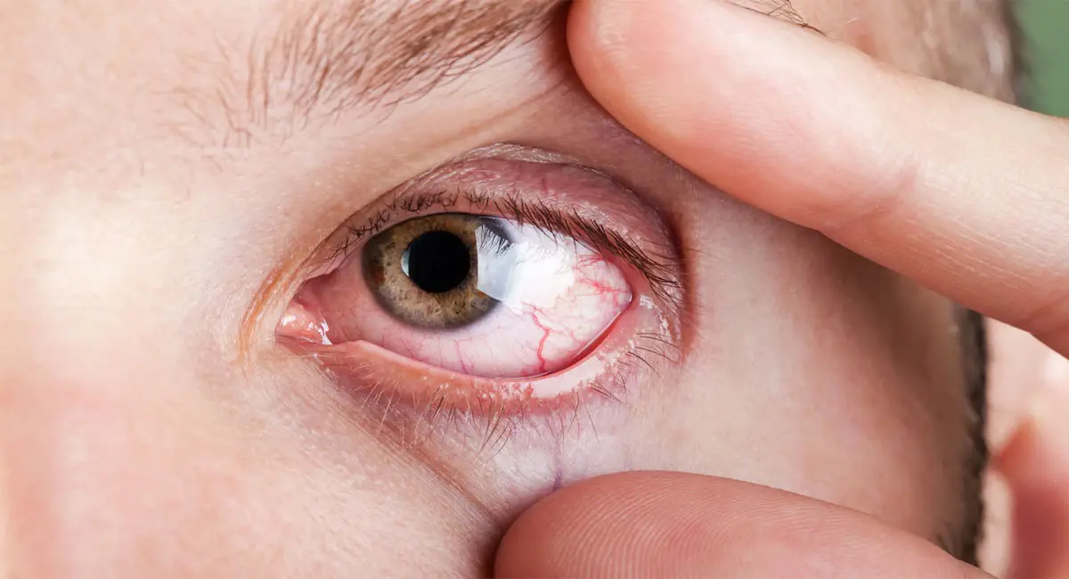 /img/10/1775993360357