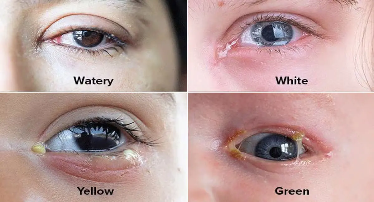 /img/10/1775993432310