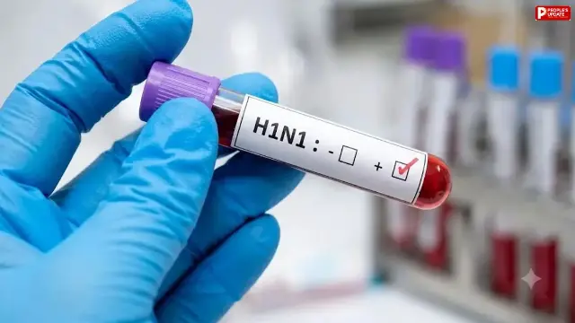भोपाल में स्वाइन फ्लू का बढ़ा खतरा, H1N1 से दो की मौत; मरीजों की संख्या 72 पहुंची