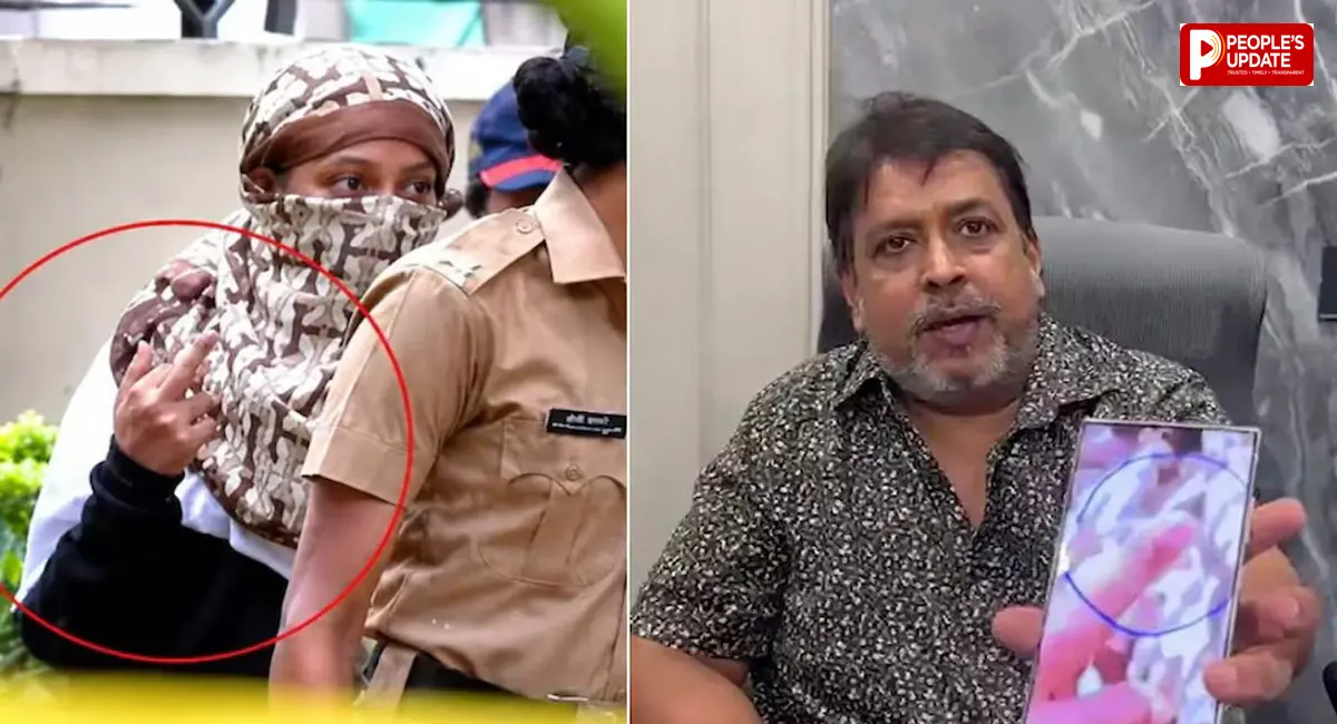बोले- उंगलियां कार के दरवाजे में फंसी थीं, तस्वीर को गलत तरीके से दिखाया गया