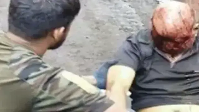 NRBS स्टील प्लांट में दर्दनाक हादसा: हाइड्रा की टक्कर से HR हेड की मौत, पैदल जा रहे अधिकारी को पीछे से मारी टक्कर
