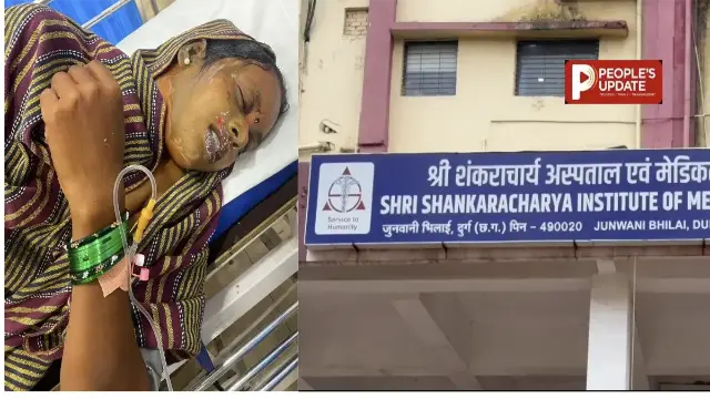 कांवड़ यात्रा में महिला पर एसिड अटैक, दो बच्चे भी झुलसे
