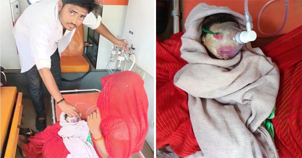 एमपी में जन्मा एलियन जैसा दिखने वाला बेबी, दुर्लभ कोलोडियन बीमारी से ग्रसित, हालत नाजुक