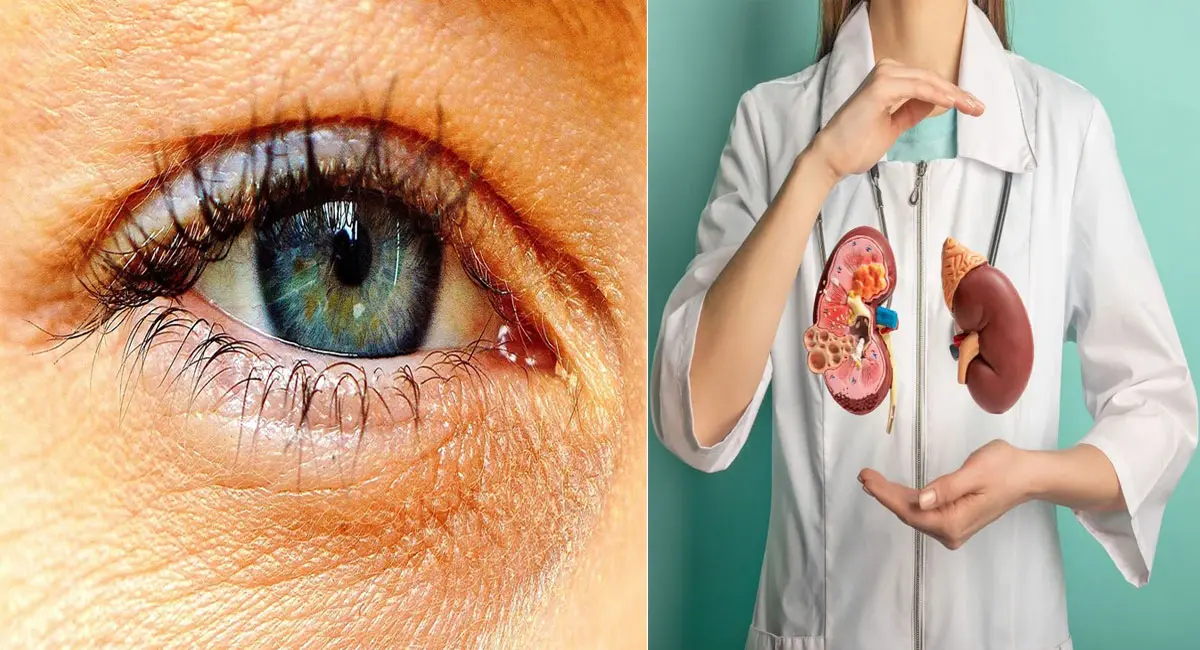 चुपचाप खराब हो रही है किडनी, इन संकेतों को न करें इग्नोर