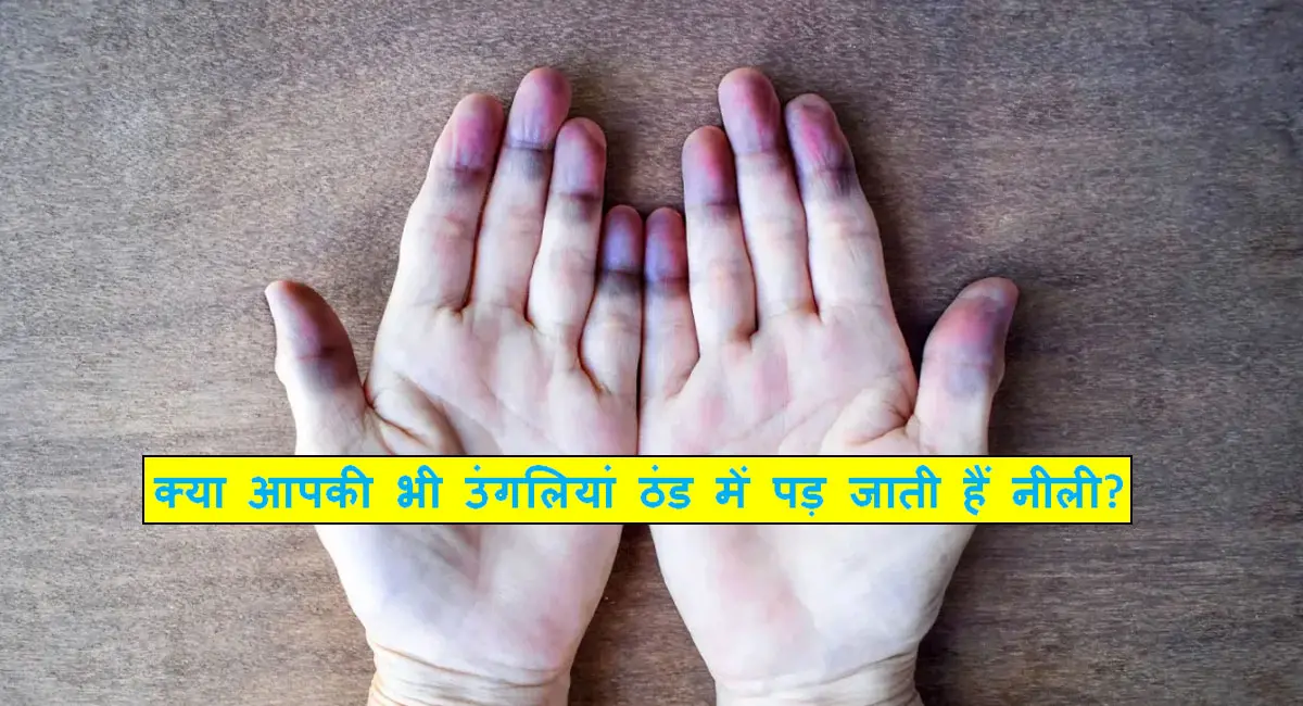 सर्दियों में उंगलियां क्यों पड़ जाती हैं नीली? जानिए रेनाड्स सिंड्रोम का सच