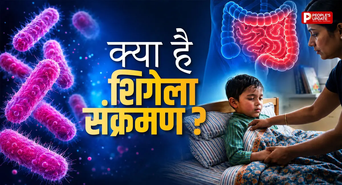 क्या है शिगेला संक्रमण? बच्चों में तेजी से फैल रही खतरनाक आंतों की बीमारी, जानें इसके लक्षण