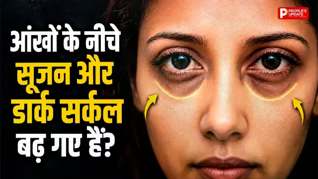 नींद पूरी फिर भी डार्क सर्कल्स? चेहरा दे रहा गंभीर बीमारी का संकेत, जानिए असली कारण