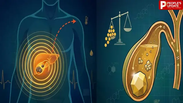 गॉल ब्लैडर में क्यों बनती है पथरी? जानें कारण, लक्षण, बचाव और इलाज