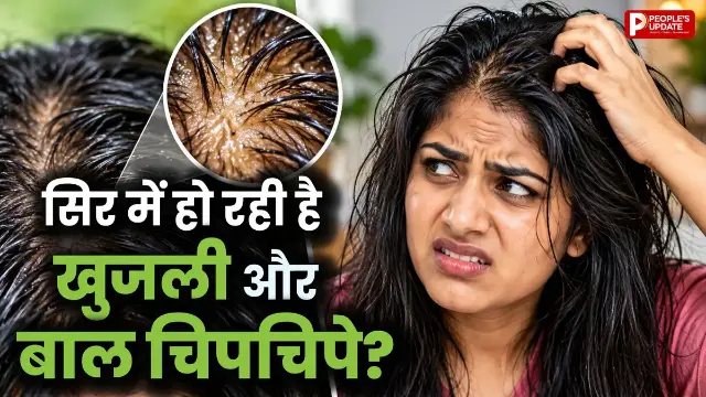 मौसम बदलते ही बालों में बढ़ गई खुजली और डैंड्रफ? दादी-नानी के ये नुस्खे आएंगे काम