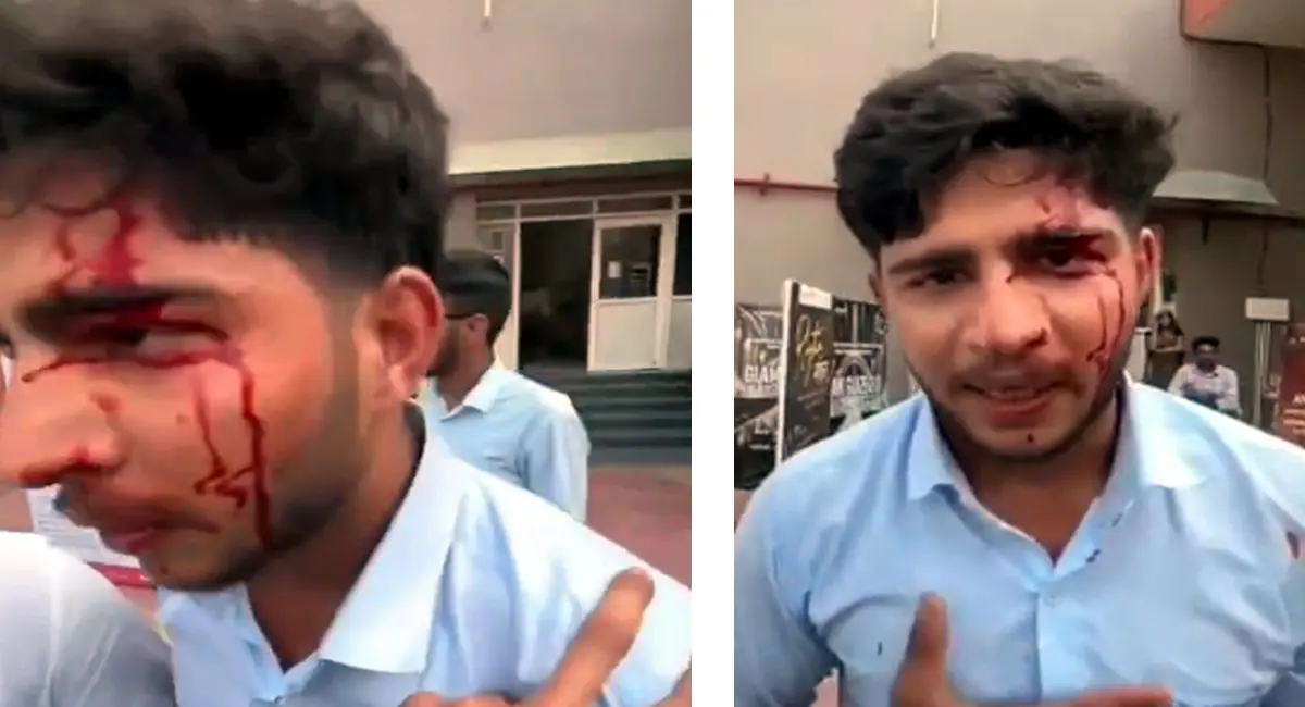 कॉलेज में फिर विवाद, फीस प्रदर्शन के दौरान छात्र घायल — लहूलुहान छात्र ने एबीवीपी कार्यकर्ताओं पर हमला करने की कही बात