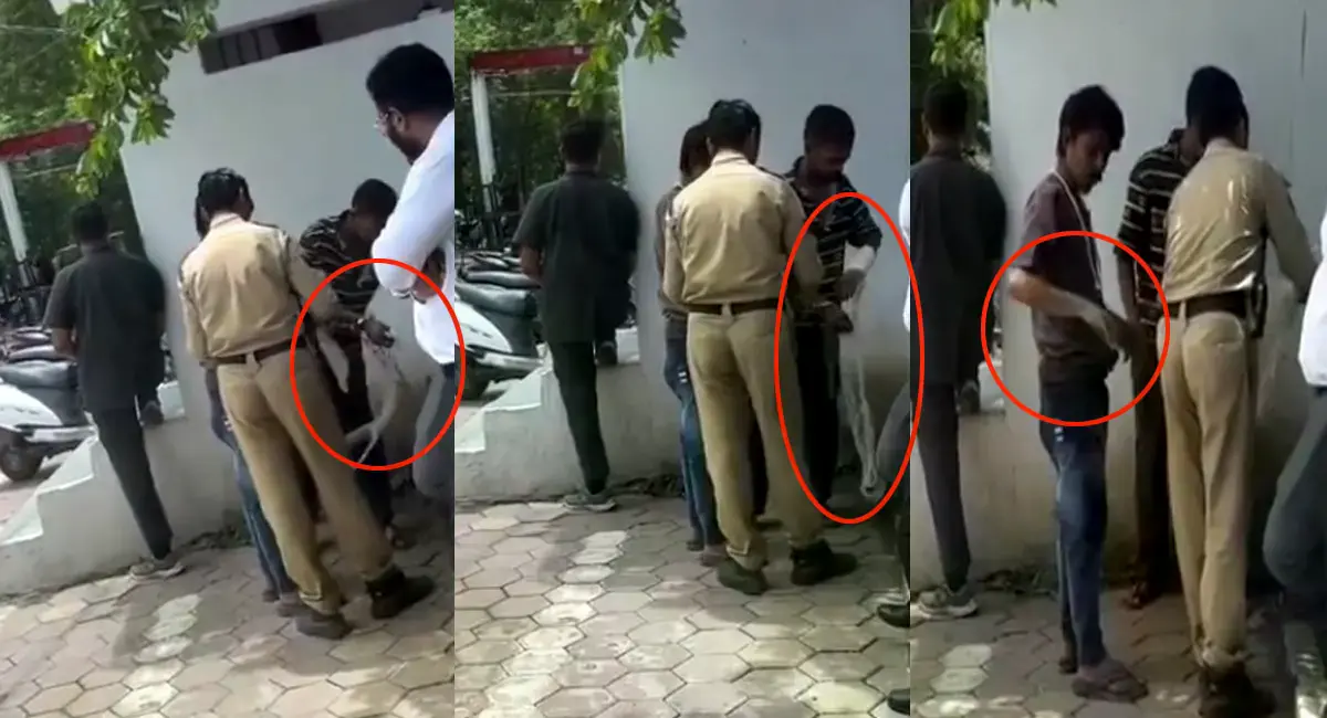 डॉक्टर ने कहा- कोई प्लास्टर नहीं लगाया, जांच में कई पुलिसकर्मी घेरे में