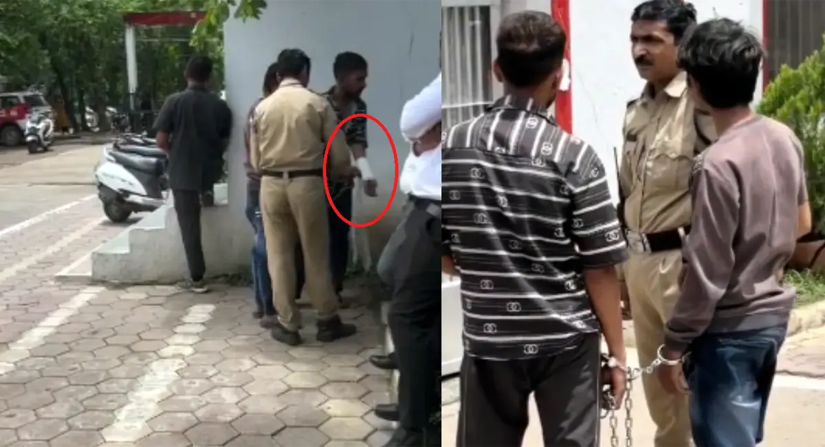डॉक्टर ने कहा- कोई प्लास्टर नहीं लगाया, जांच में कई पुलिसकर्मी घेरे में