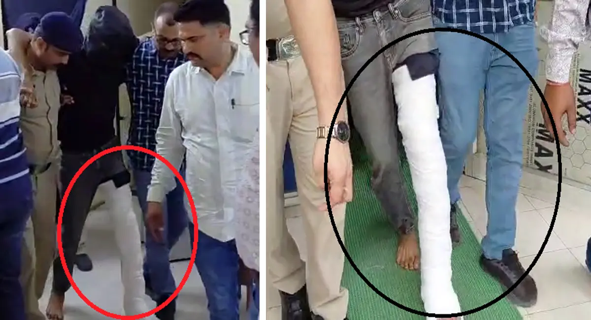 आरोपी के पैर में पट्टा, लेकिन आंखों पर पट्टी किसकी?
