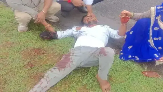 दमोह में सरपंच ने मामूली विवाद में युवक का कुल्हाड़ी से काटा युवक के हाथ का पंजा