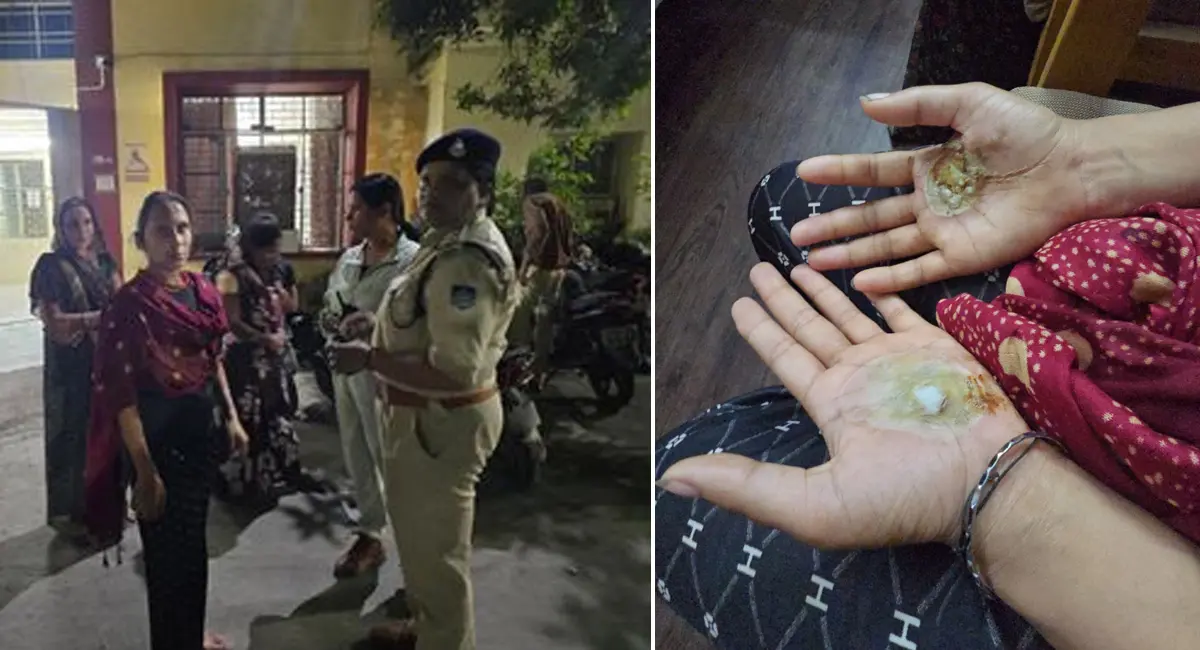 महिला के माथे पर चिपकाया गर्म सिक्का, 'भूत' निकालने के लिए घंटों दी यातना, जानिए पूरा मामला 
