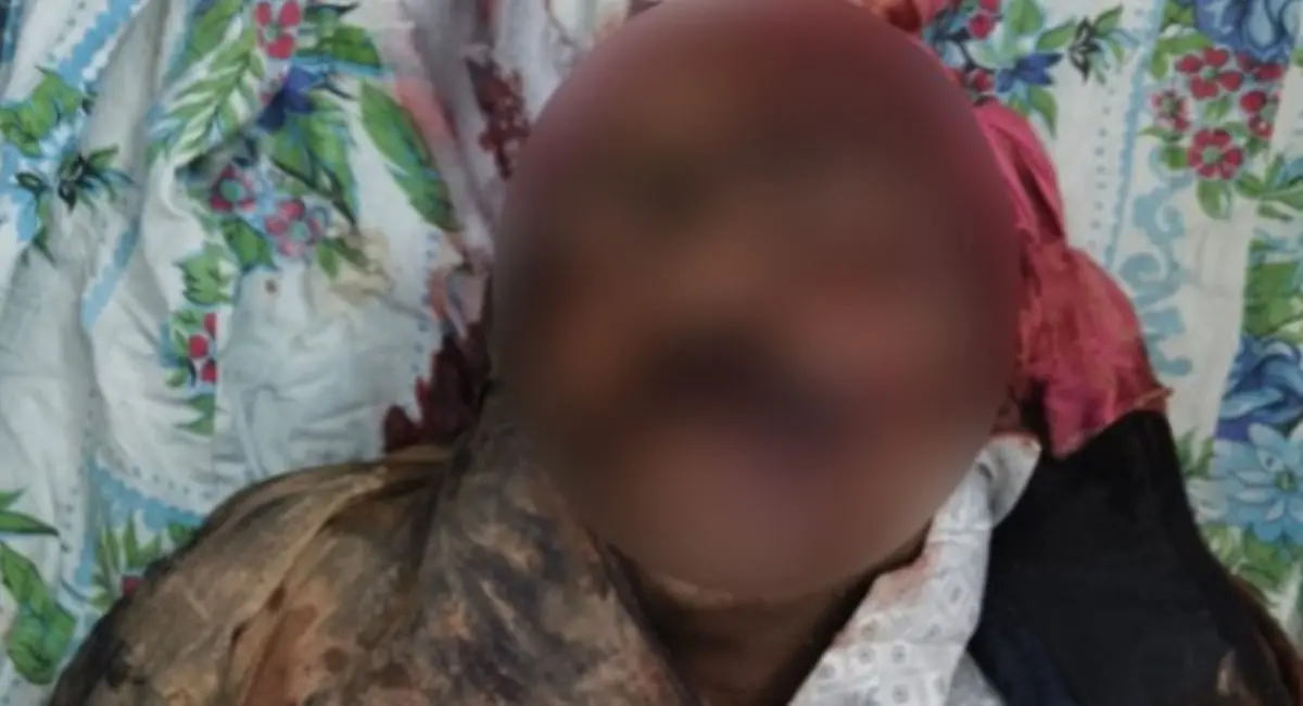 5 किमी की दूरी तय करने में एंबुलेंस को लगे 30 मिनट 