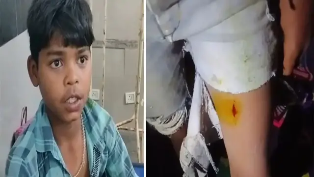 14 साल के सत्यम ने दिखाई बहादुरी, हाथ- पैर में चोटें, वन विभाग ने कराया इलाज